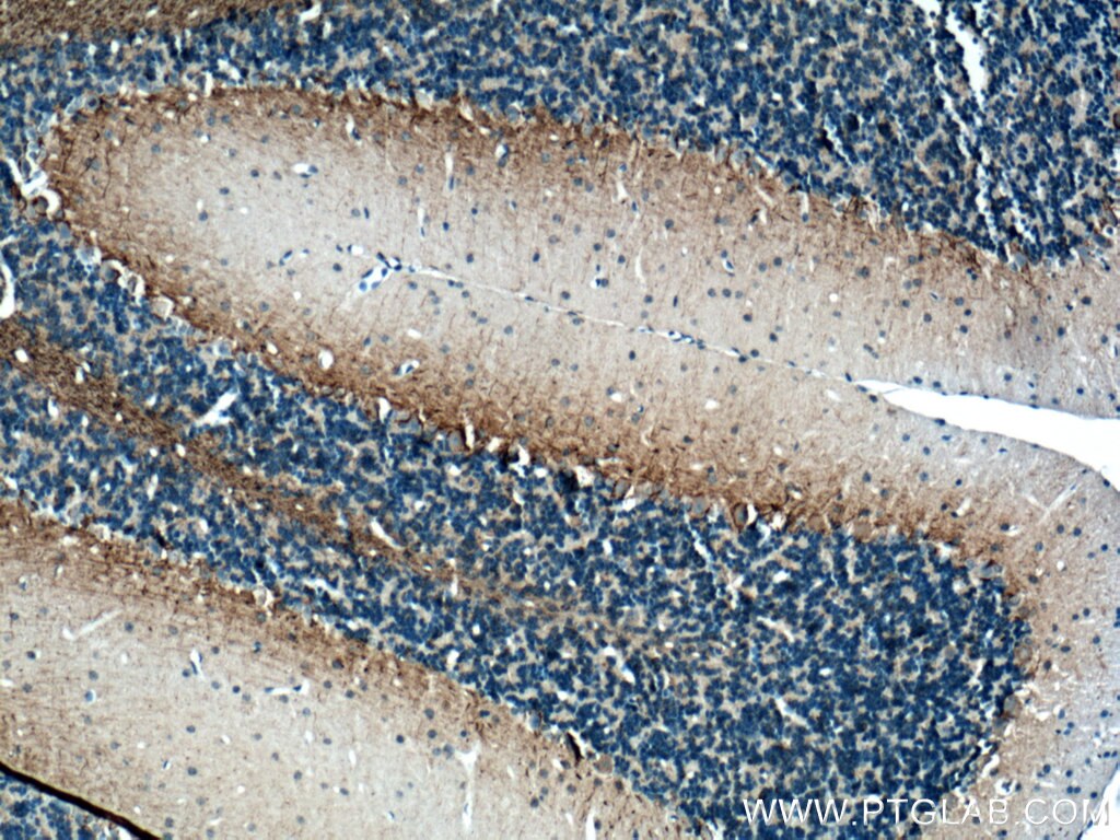 Immunohistochemistry (IHC) staining of mouse cerebellum tissue using NF-M Polyclonal antibody (25805-1-AP)