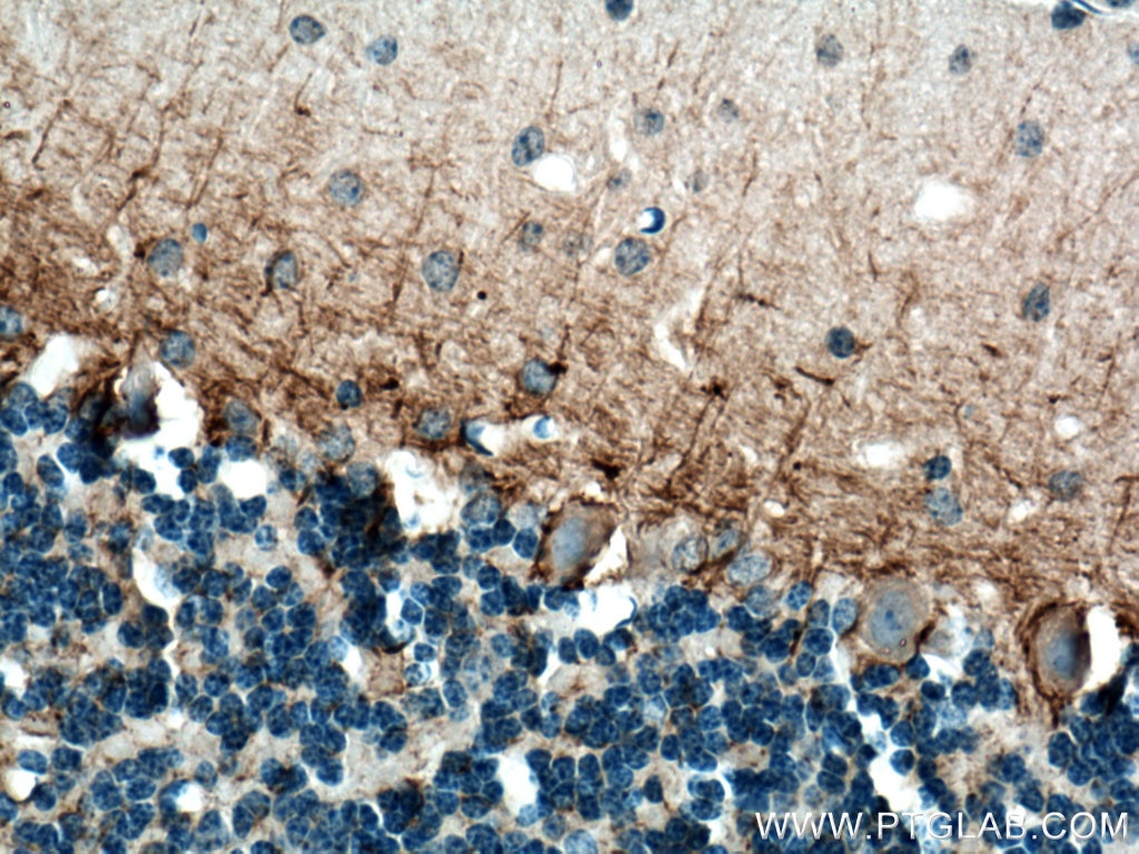 Immunohistochemistry (IHC) staining of mouse cerebellum tissue using NF-M Polyclonal antibody (25805-1-AP)