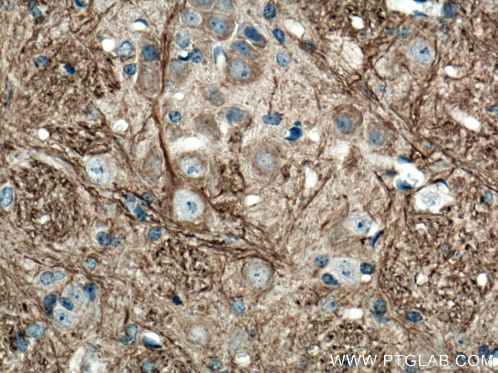 IHC staining of mouse cerebellum using 25805-1-AP