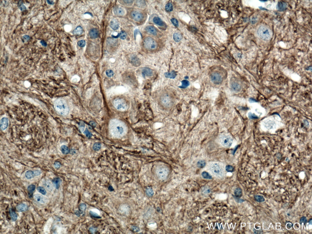 Immunohistochemistry (IHC) staining of mouse cerebellum tissue using NF-M Polyclonal antibody (25805-1-AP)