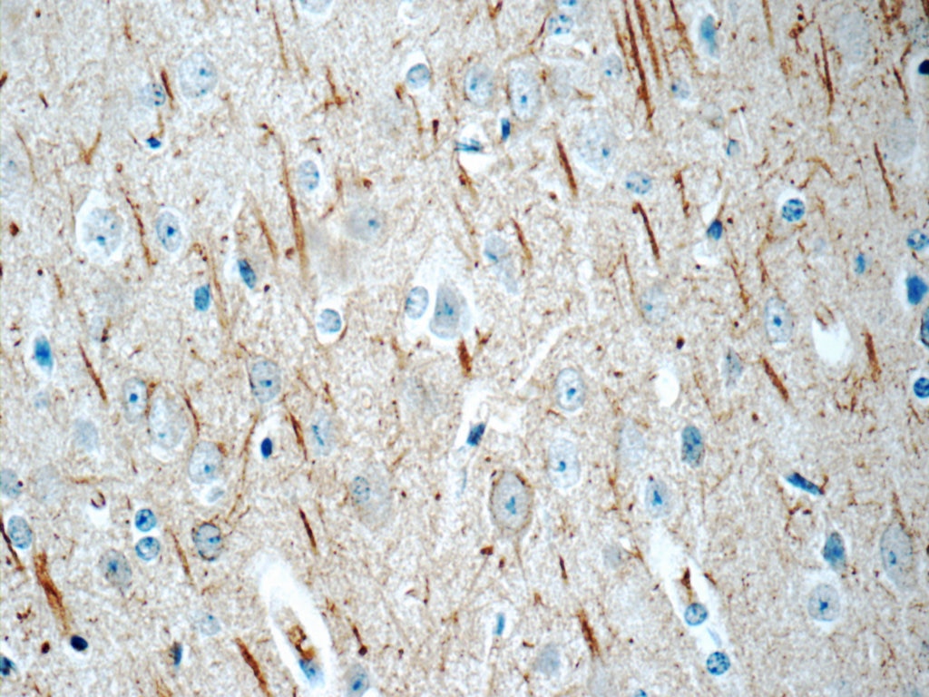 Immunohistochemistry (IHC) staining of mouse brain tissue using NF-M Polyclonal antibody (25805-1-AP)