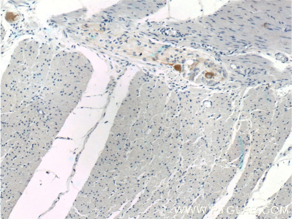 IHC staining of human colon using 25805-1-AP