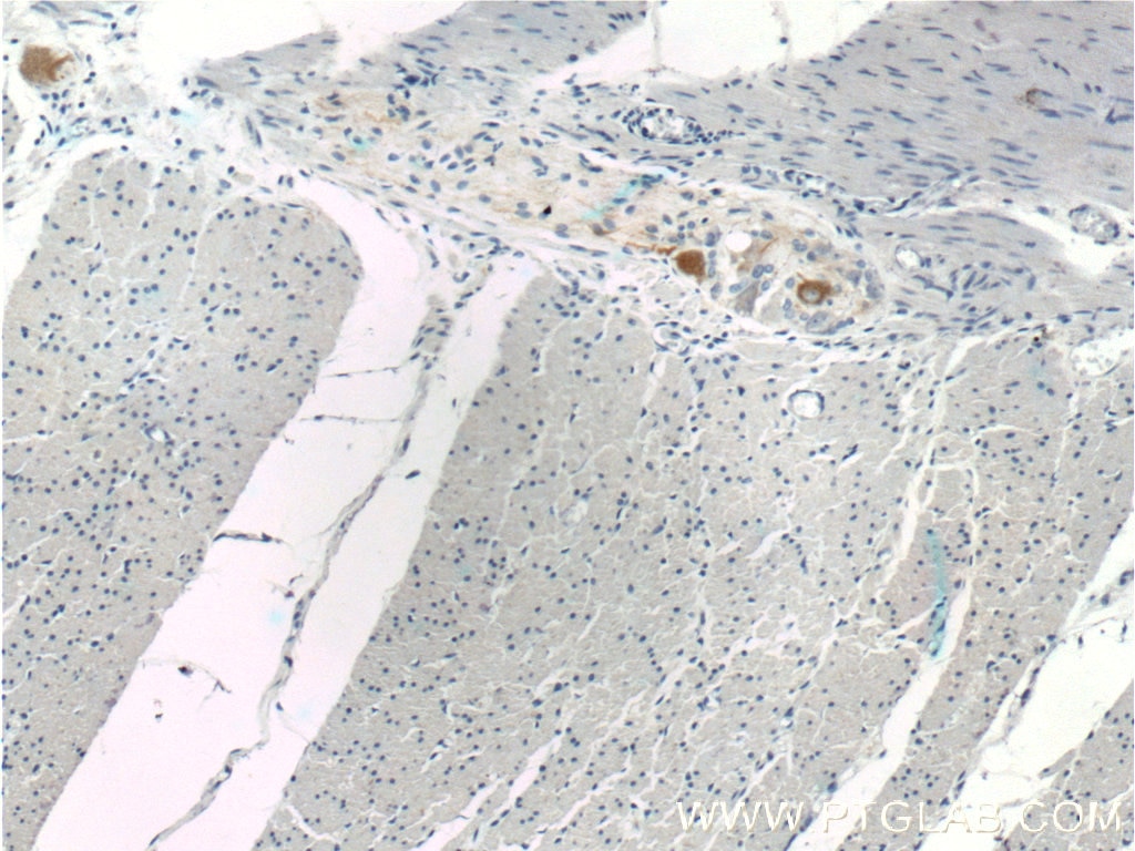 Immunohistochemistry (IHC) staining of human colon tissue using NF-M Polyclonal antibody (25805-1-AP)