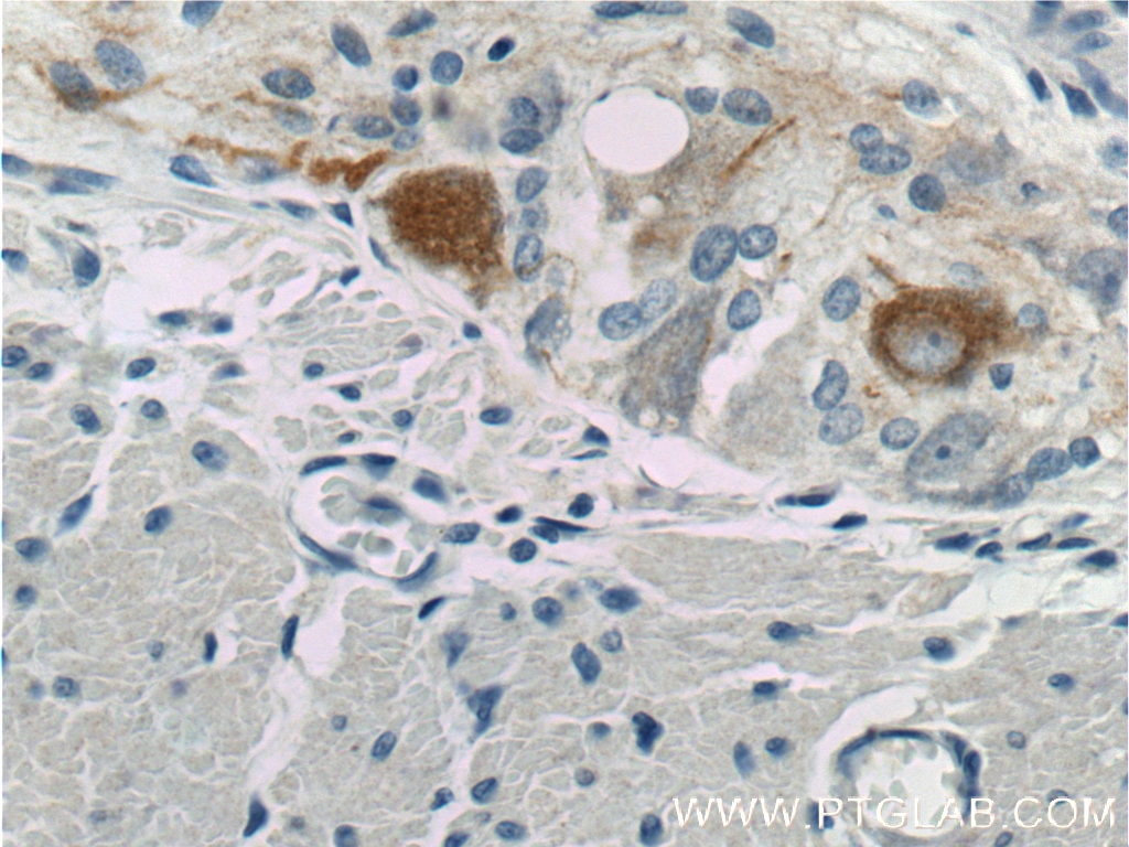 IHC staining of human colon using 25805-1-AP