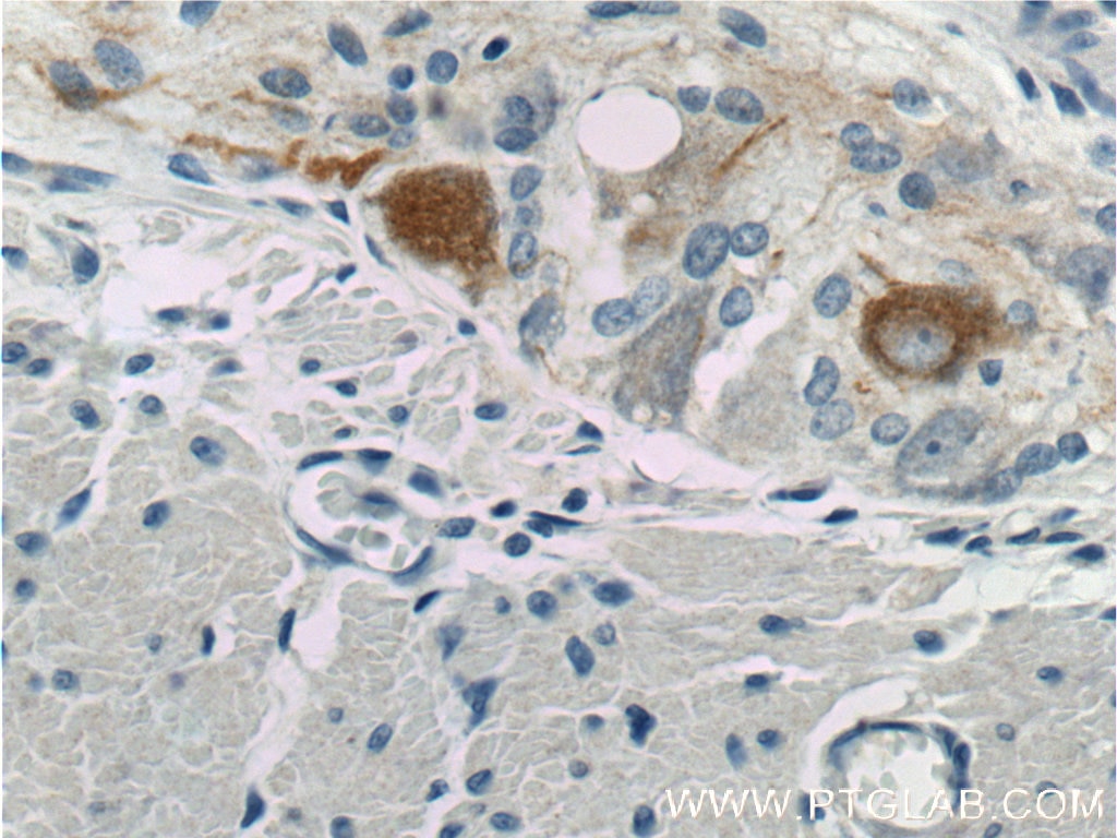 Immunohistochemistry (IHC) staining of human colon tissue using NF-M Polyclonal antibody (25805-1-AP)