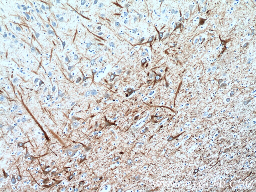 Immunohistochemistry (IHC) staining of human brain tissue using NF-M Polyclonal antibody (25805-1-AP)