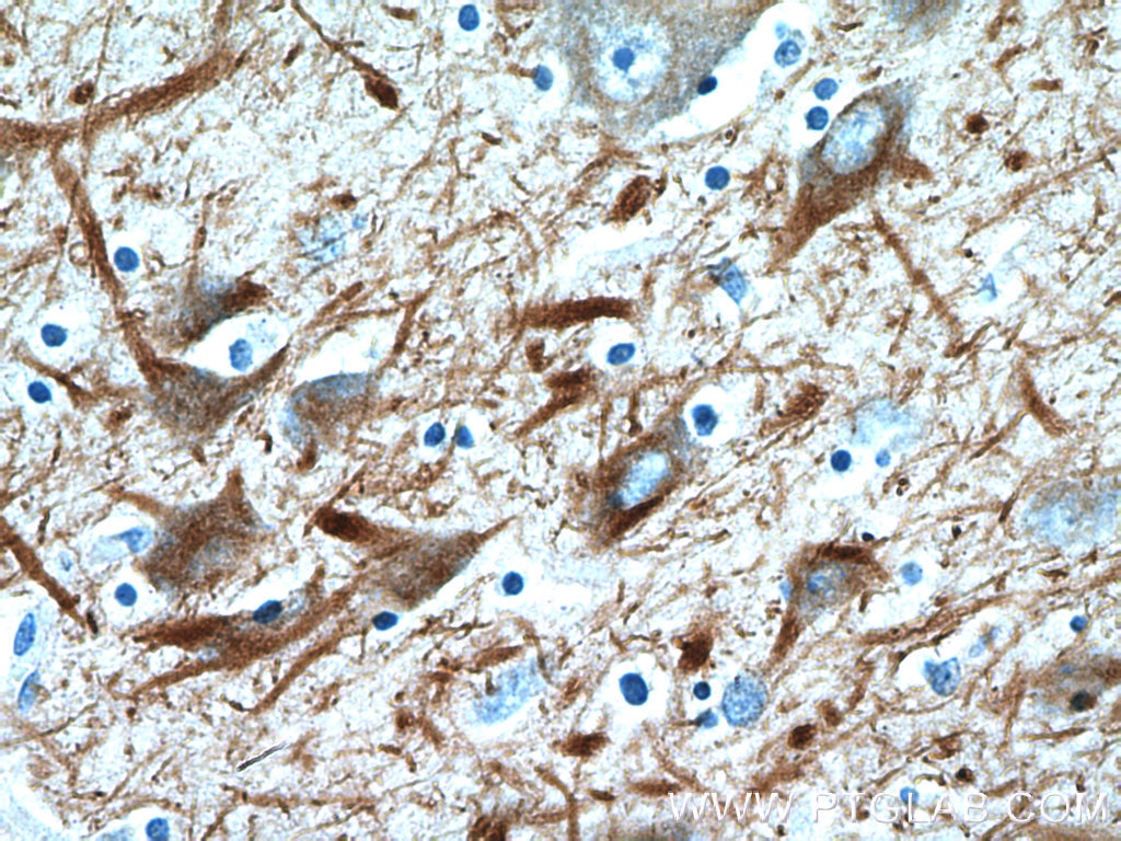 Immunohistochemistry (IHC) staining of human brain tissue using NF-M Polyclonal antibody (25805-1-AP)