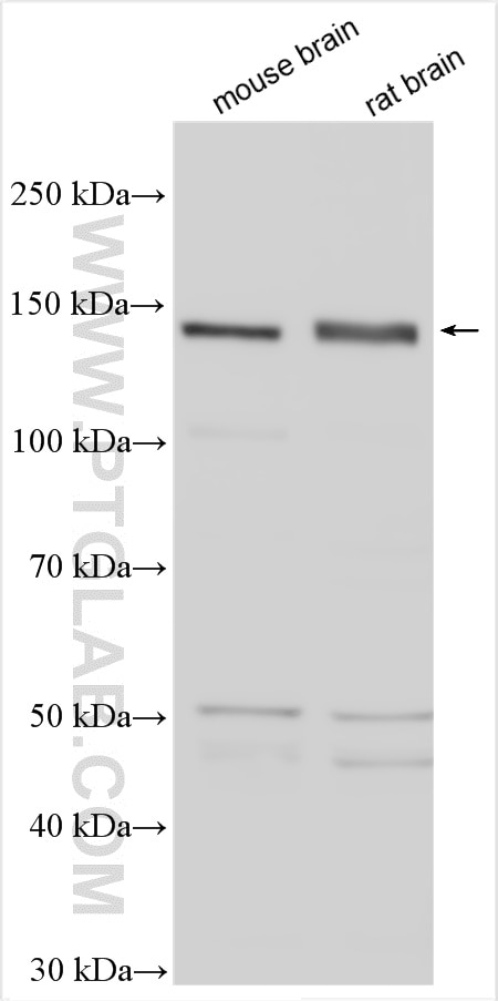 Western Blot (WB) analysis of various lysates using NF-M Polyclonal antibody (25805-1-AP)