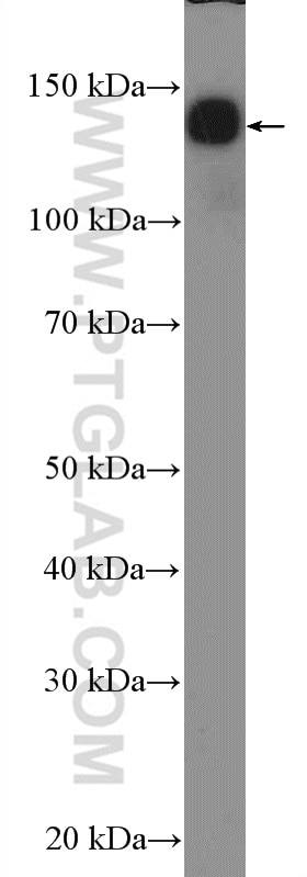 Western Blot (WB) analysis of mouse brain tissue using NF-M Polyclonal antibody (25805-1-AP)