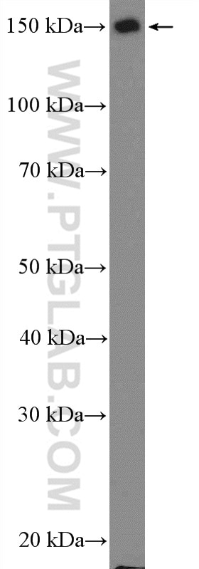 Western Blot (WB) analysis of rat brain tissue using NF-M Polyclonal antibody (25805-1-AP)