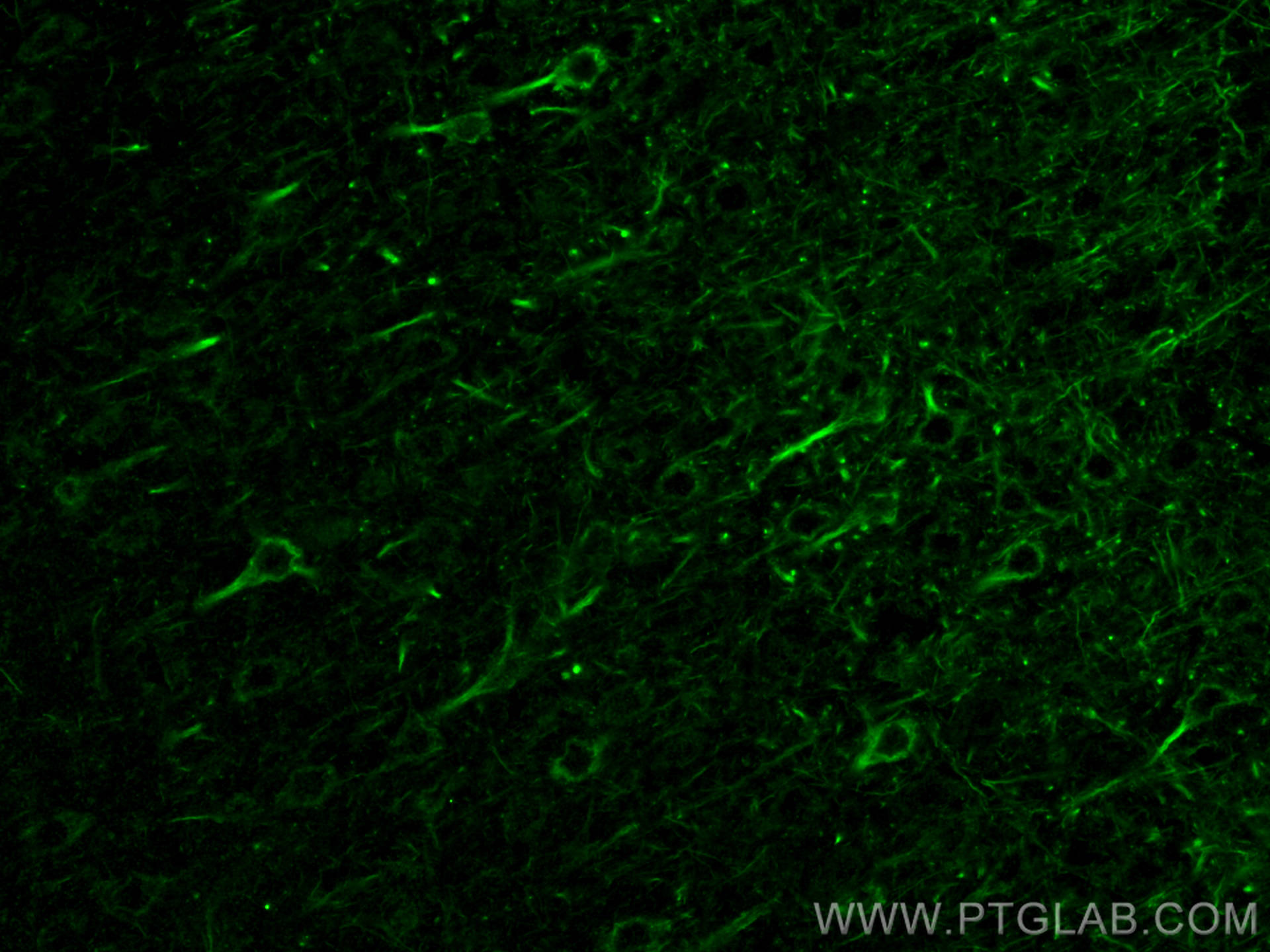 Immunofluorescent analysis of (4% PFA) fixed paraffin-embedded mouse brain tissue using NF-M antibody (66396-1-Ig, Clone: 2E3B12 ) at dilution of 1:400 and CoraLite®488-Conjugated AffiniPure Goat Anti-Mouse IgG(H+L) (SA00013-1). Heat mediated antigen retrieval with Tris-EDTA buffer (pH 9.0). Immunofluorescence (IF) / fluorescent staining of mouse brain tissue using NF-M Monoclonal antibody (66396-1-Ig)