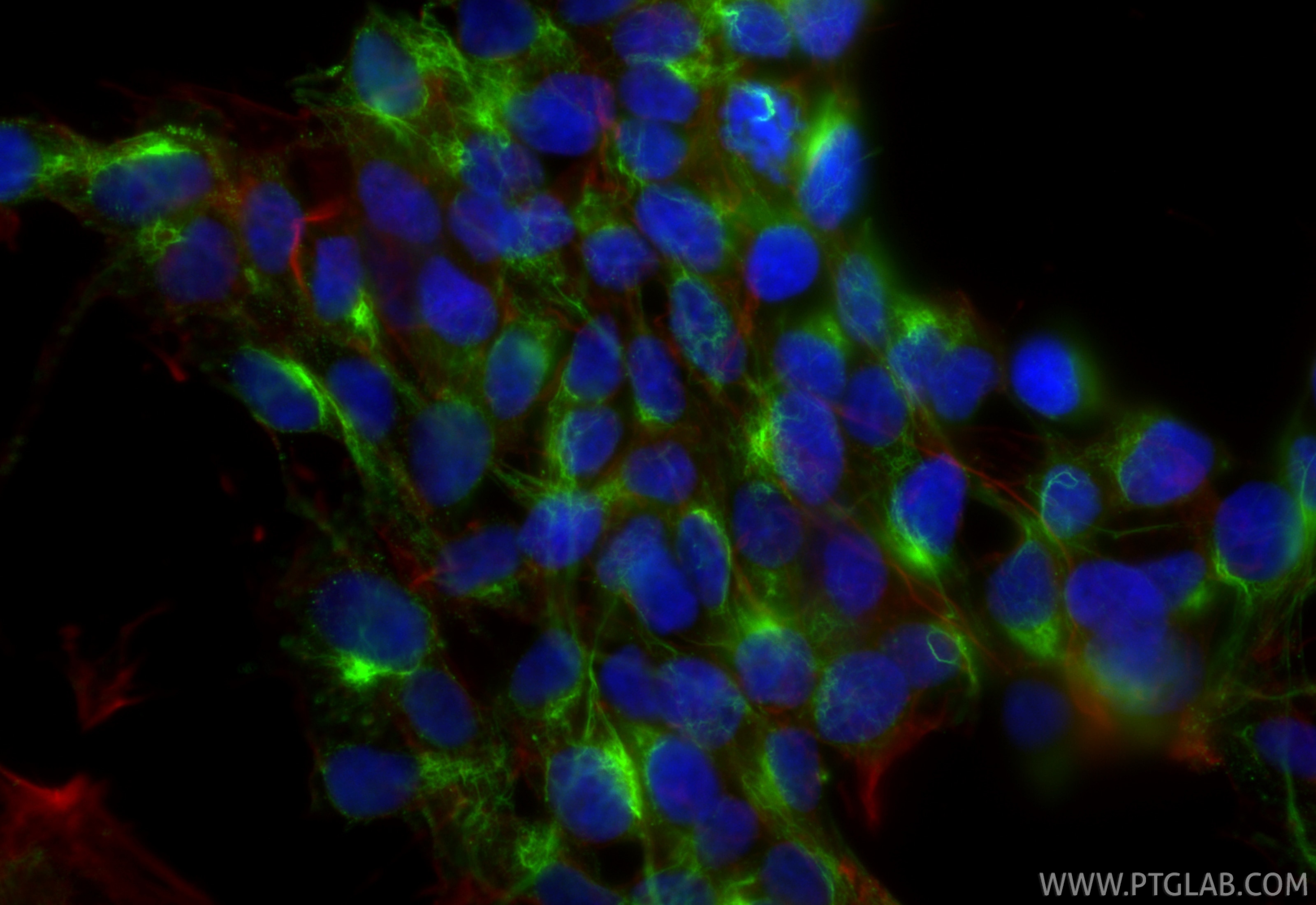 Immunofluorescent analysis of (4% PFA) fixed SH-SY5Y cells using NF-M antibody (66396-1-Ig, Clone: 2E3B12 ) at dilution of 1:400 and CoraLite®488-Conjugated Goat Anti-Mouse IgG(H+L) (SA00013-1), CL594-Phalloidin (red). Immunofluorescence (IF) / fluorescent staining of SH-SY5Y cells using NF-M Monoclonal antibody (66396-1-Ig)