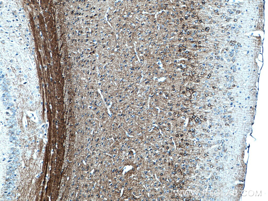 Immunohistochemistry (IHC) staining of mouse brain tissue using NF-M Monoclonal antibody (66396-1-Ig)