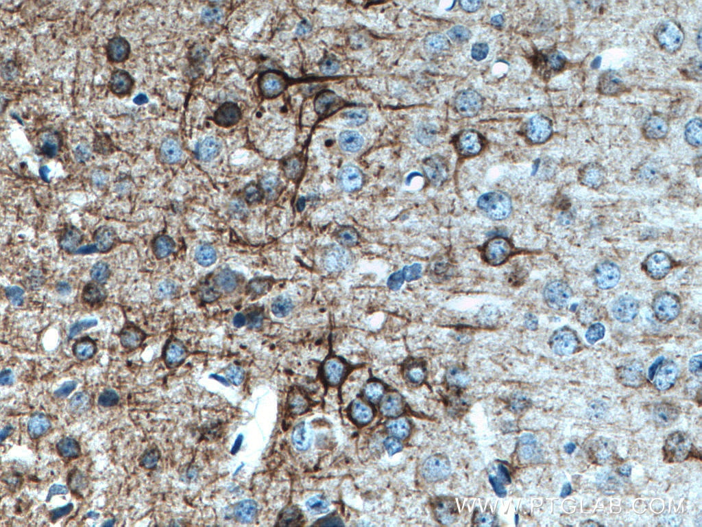 Immunohistochemistry (IHC) staining of mouse brain tissue using NF-M Monoclonal antibody (66396-1-Ig)