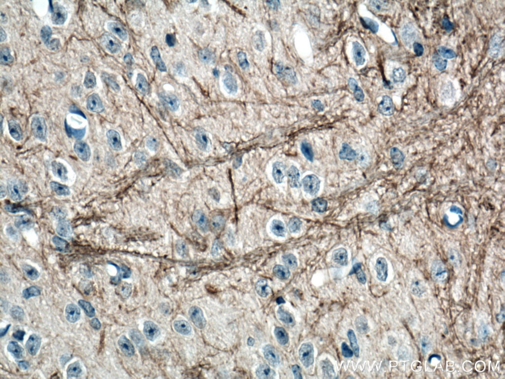 Immunohistochemistry (IHC) staining of mouse cerebellum tissue using NF-M Monoclonal antibody (66396-1-Ig)