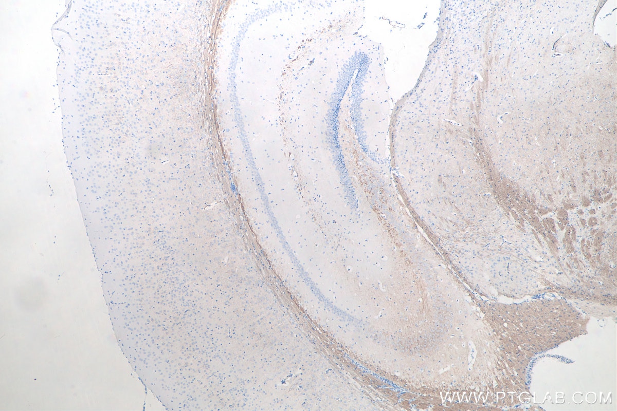 Immunohistochemistry (IHC) staining of mouse brain tissue using NF-M Monoclonal antibody (66396-1-Ig)