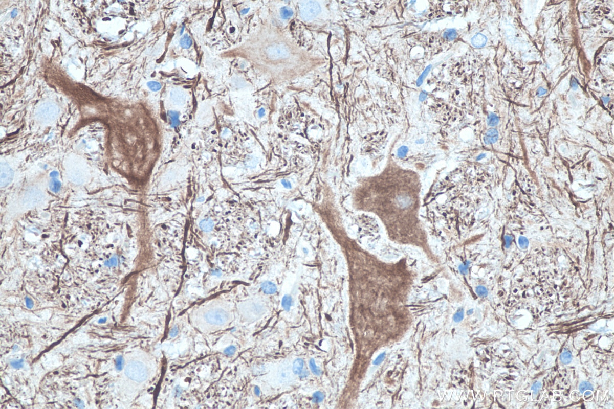 Immunohistochemistry (IHC) staining of rat cerebellum tissue using NF-M Monoclonal antibody (66396-1-Ig)