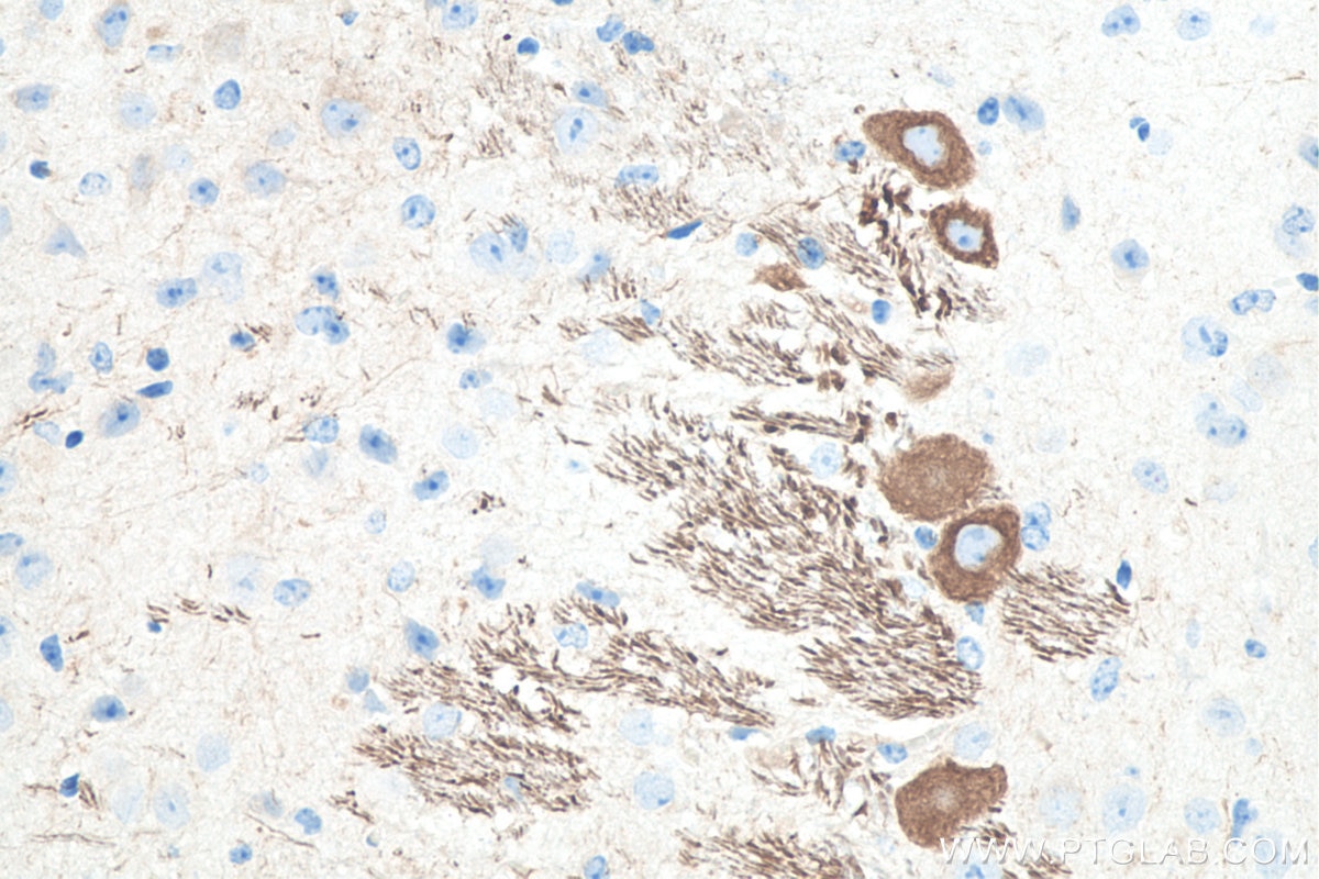 Immunohistochemistry (IHC) staining of mouse cerebellum tissue using NF-M Monoclonal antibody (66396-1-Ig)
