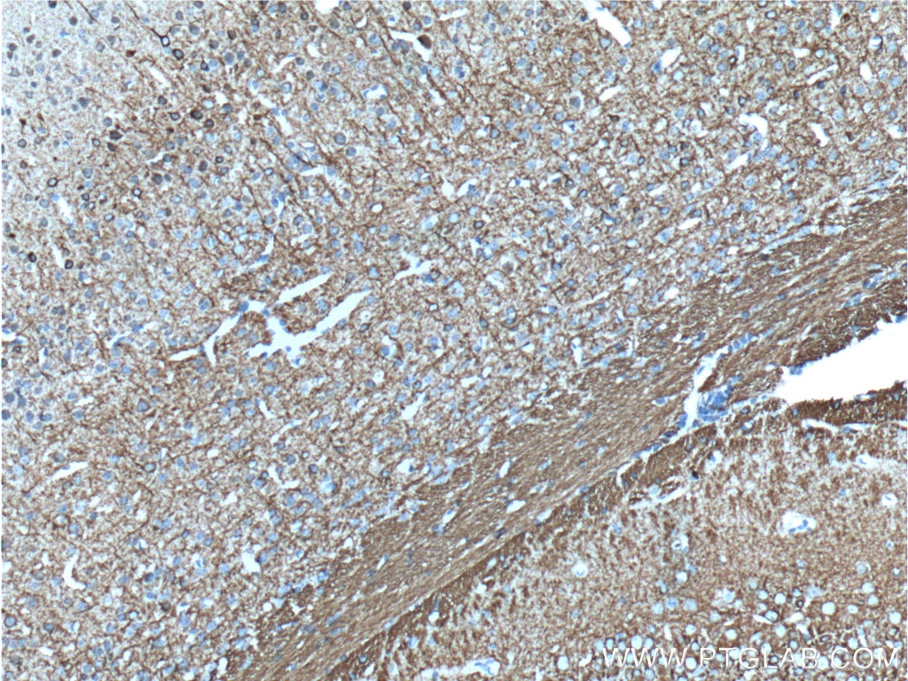 Immunohistochemistry (IHC) staining of mouse brain tissue using NF-M Monoclonal antibody (66396-1-Ig)