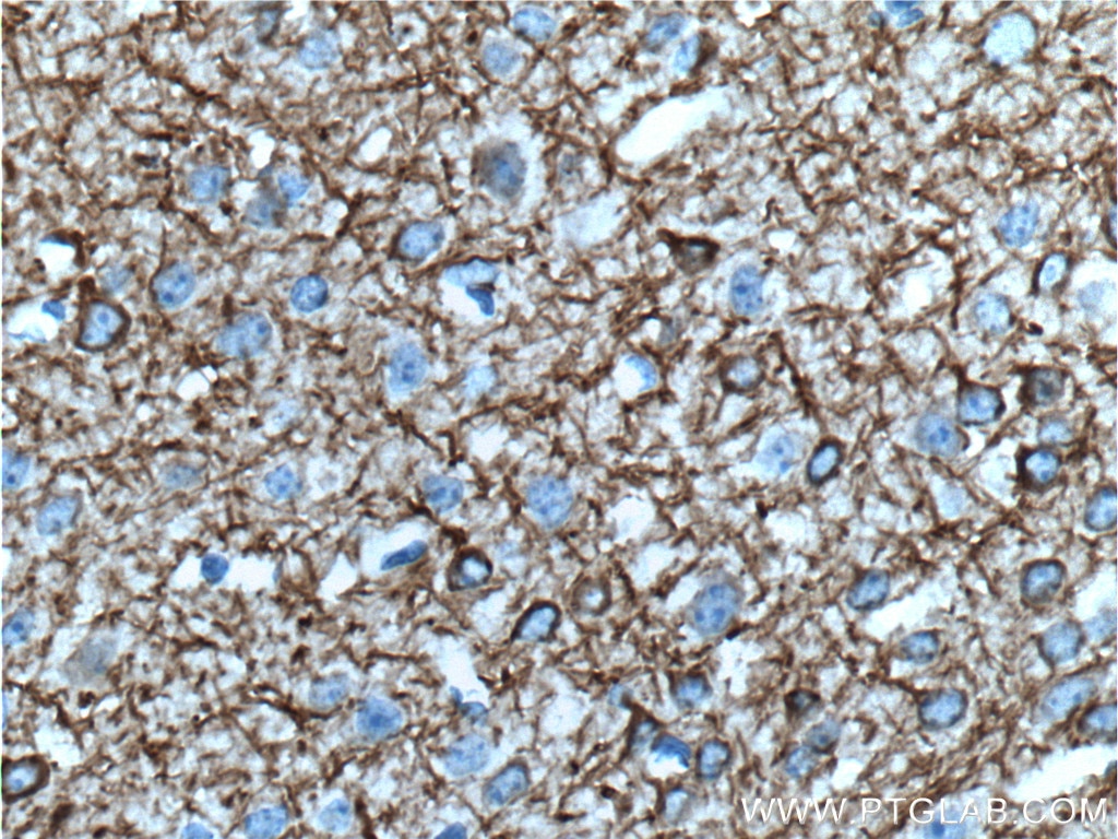 Immunohistochemistry (IHC) staining of mouse brain tissue using NF-M Monoclonal antibody (66396-1-Ig)