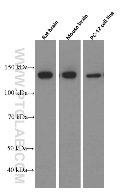 Western Blot (WB) analysis of rat brain tissue using NF-M Monoclonal antibody (66396-1-Ig)