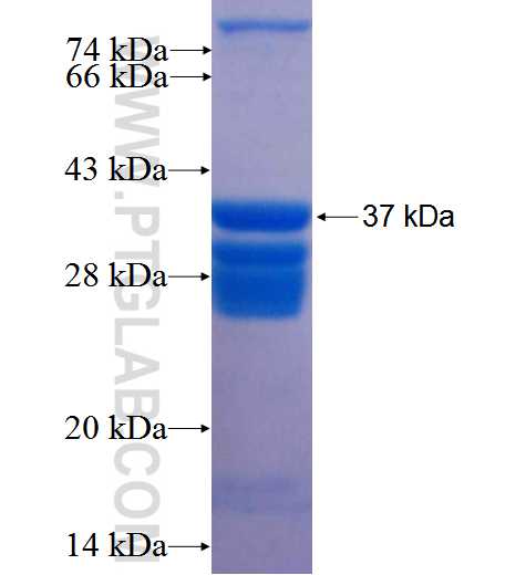 NEFM fusion protein Ag22709 SDS-PAGE