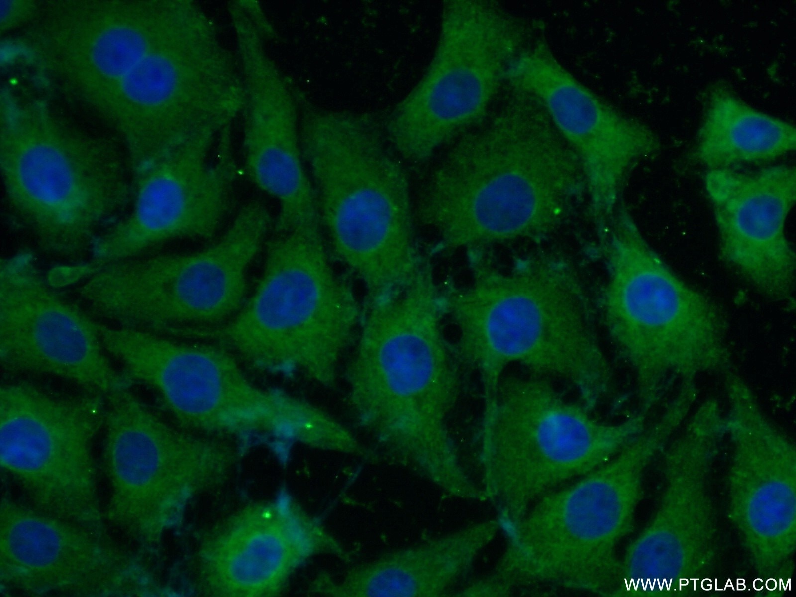 Immunofluorescence (IF) / fluorescent staining of SH-SY5Y cells using NF-M-Specific Polyclonal antibody (20664-1-AP)