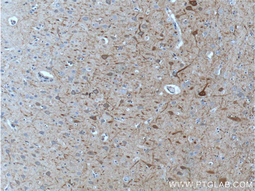 Immunohistochemistry (IHC) staining of human brain tissue using NF-M-Specific Polyclonal antibody (20664-1-AP)