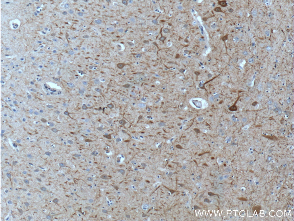 IHC staining of human brain using 20664-1-AP