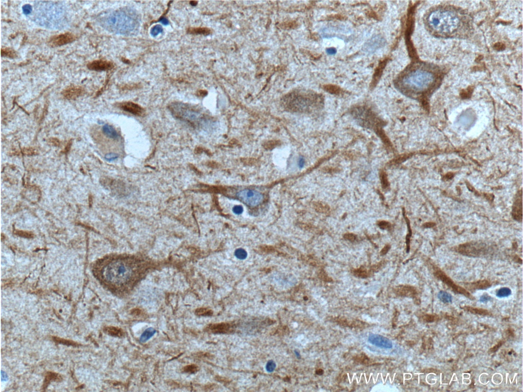 Immunohistochemistry (IHC) staining of human brain tissue using NF-M-Specific Polyclonal antibody (20664-1-AP)