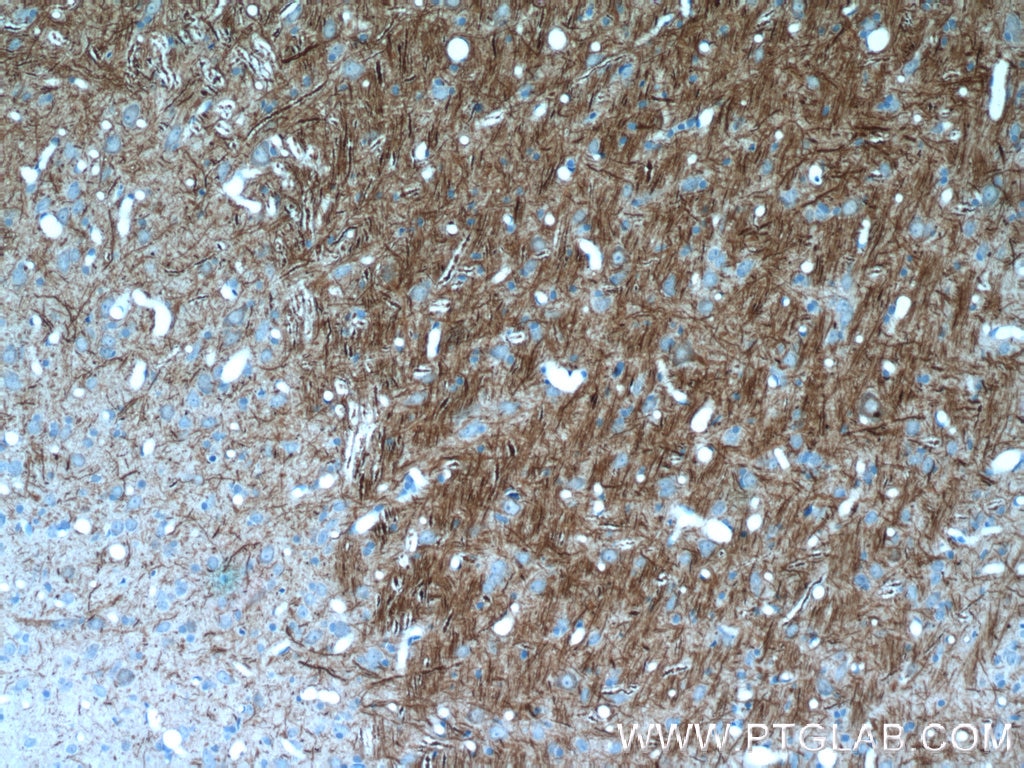 Immunohistochemistry (IHC) staining of rat brain tissue using NF-M-Specific Polyclonal antibody (20664-1-AP)