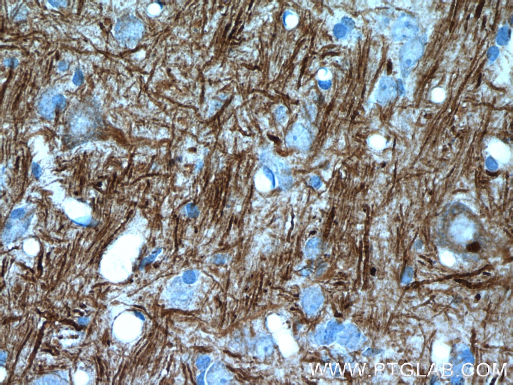 Immunohistochemistry (IHC) staining of rat brain tissue using NF-M-Specific Polyclonal antibody (20664-1-AP)