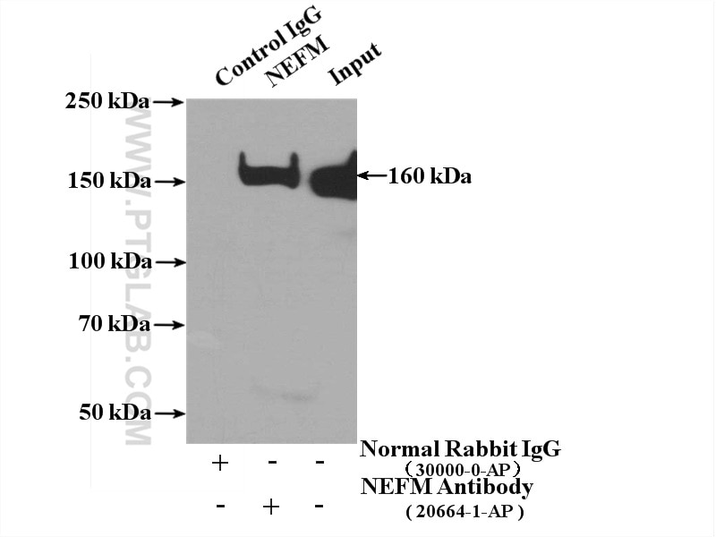 Immunoprecipitation (IP) experiment of rat brain tissue using NF-M-Specific Polyclonal antibody (20664-1-AP)