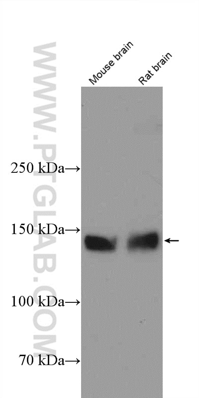 Western Blot (WB) analysis of mouse brain tissue using NF-M-Specific Polyclonal antibody (20664-1-AP)