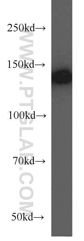 Western Blot (WB) analysis of mouse brain tissue using NF-M-Specific Polyclonal antibody (20664-1-AP)
