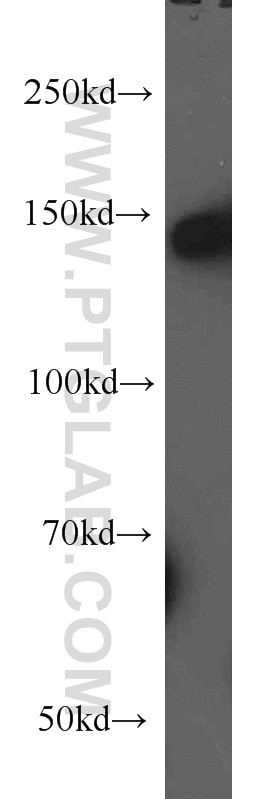 Western Blot (WB) analysis of human brain tissue using NF-M-Specific Polyclonal antibody (20664-1-AP)