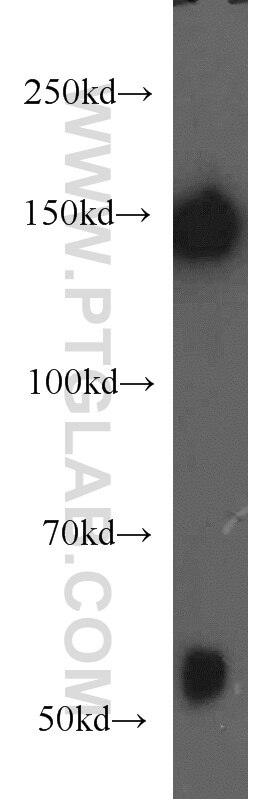 Western Blot (WB) analysis of human brain tissue using NF-M-Specific Polyclonal antibody (20664-1-AP)