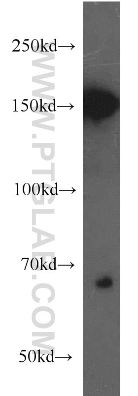 Western Blot (WB) analysis of rat brain tissue using NF-M-Specific Polyclonal antibody (20664-1-AP)