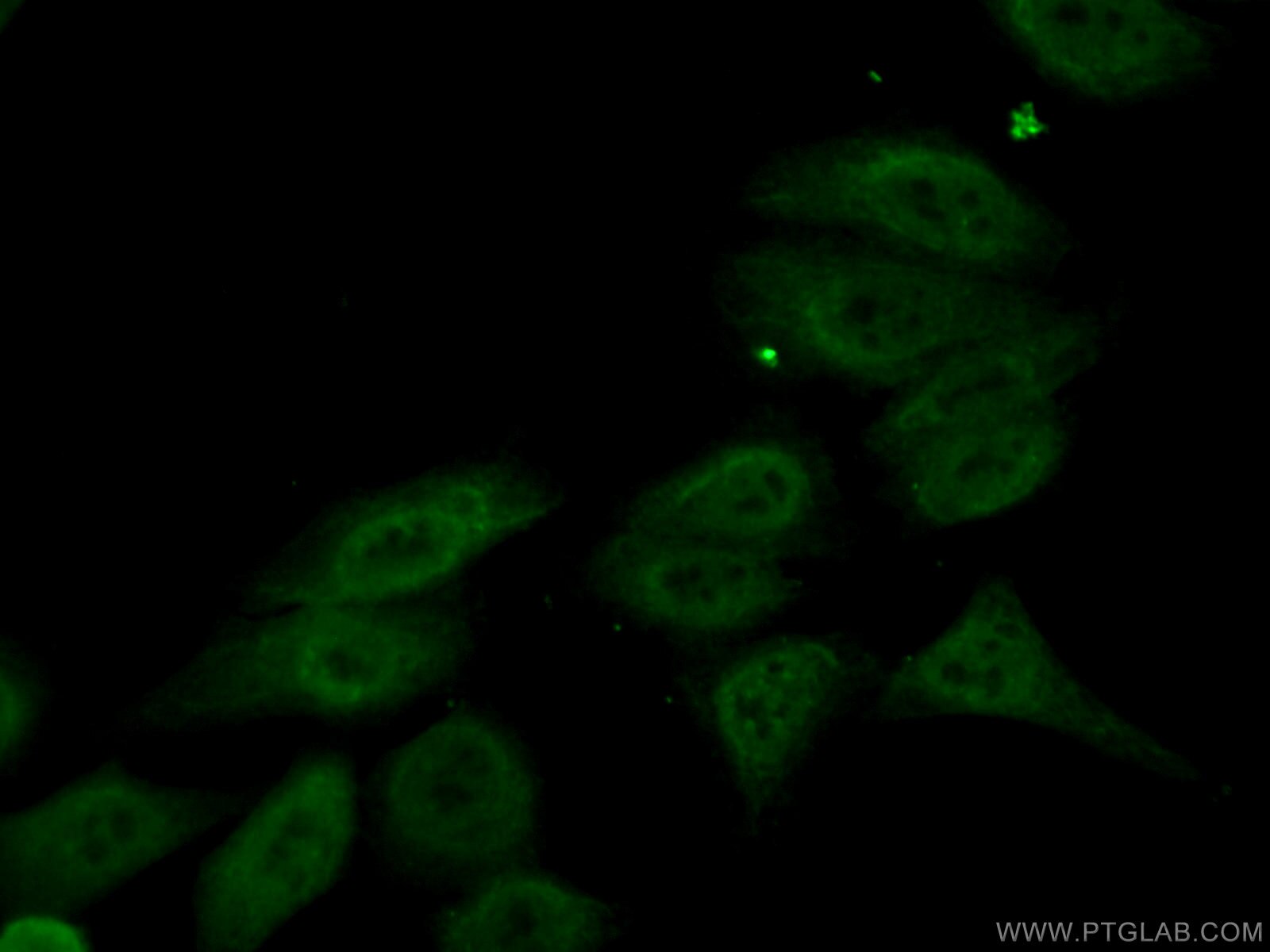 Immunofluorescence (IF) / fluorescent staining of HepG2 cells using NEIL1 Monoclonal antibody (67012-1-Ig)