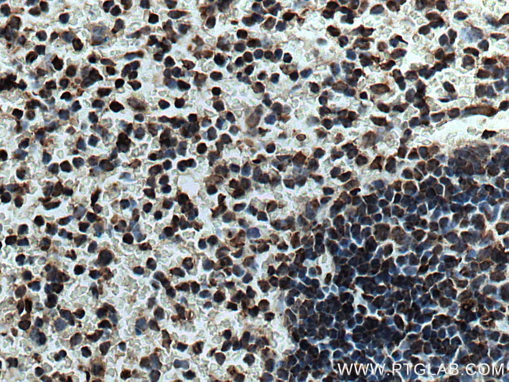 Immunohistochemistry (IHC) staining of mouse spleen tissue using NEIL1 Monoclonal antibody (67012-1-Ig)