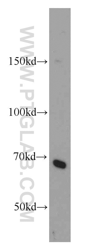 WB analysis of HEK-293 using 11621-1-AP