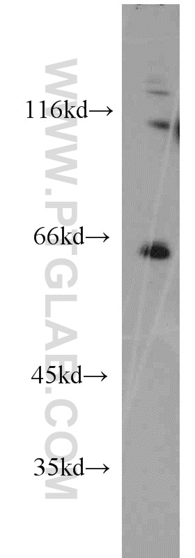 Western Blot (WB) analysis of A431 cells using NEIL3 Polyclonal antibody (11621-1-AP)