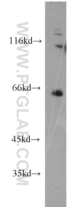 WB analysis of A431 using 11621-1-AP