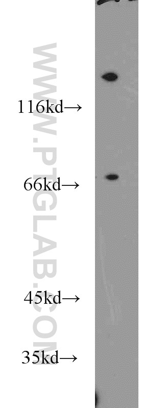 Western Blot (WB) analysis of mouse skin tissue using NEIL3 Polyclonal antibody (11621-1-AP)
