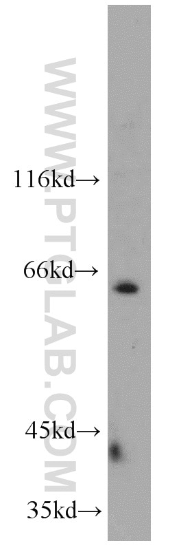 Western Blot (WB) analysis of HEK-293 cells using NEIL3 Polyclonal antibody (11621-1-AP)