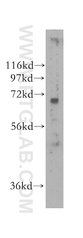 Western Blot (WB) analysis of human skin tissue using NEIL3 Polyclonal antibody (11621-1-AP)