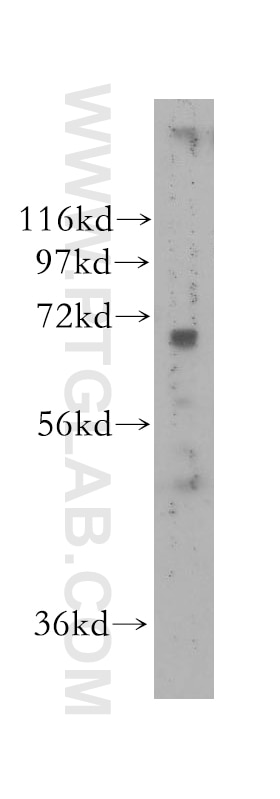 WB analysis of human skin using 11621-1-AP