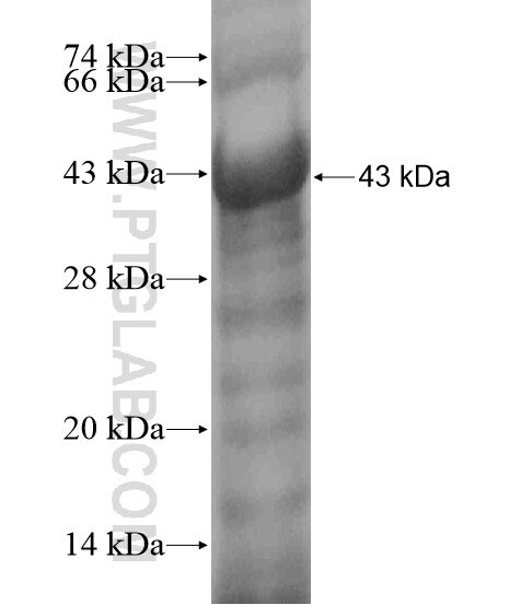NEIL3 fusion protein Ag18624 SDS-PAGE
