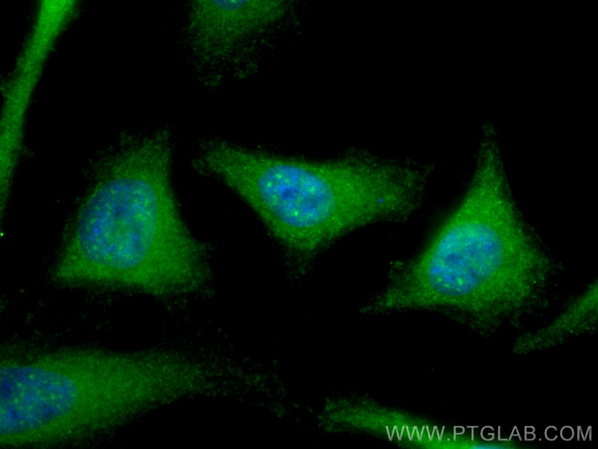 Immunofluorescence (IF) / fluorescent staining of HeLa cells using NEK1 Polyclonal antibody (27146-1-AP)