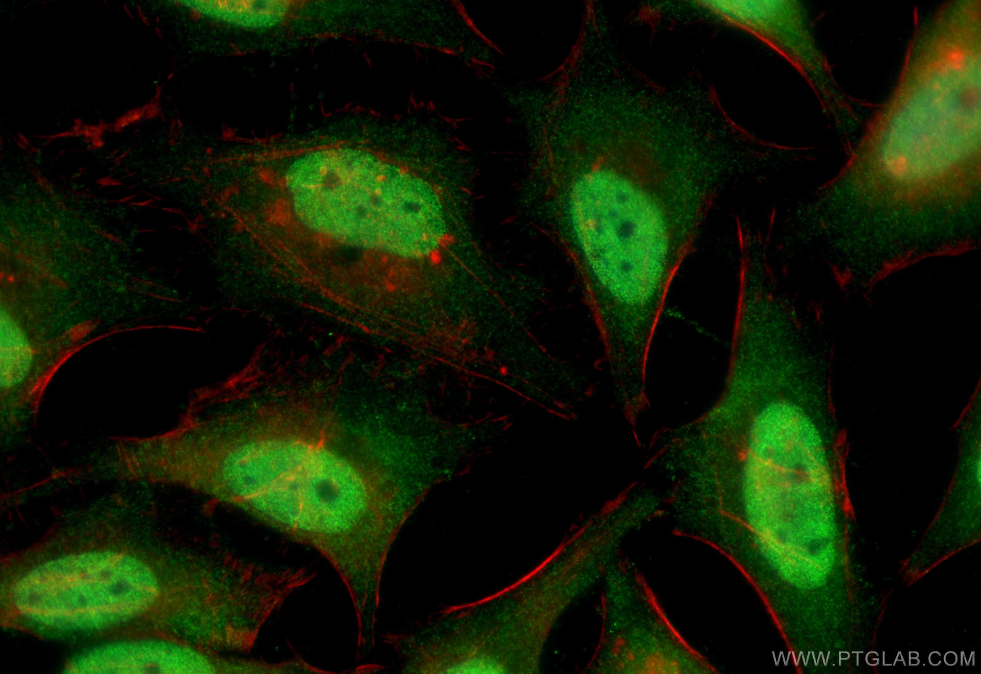 Immunofluorescence (IF) / fluorescent staining of HeLa cells using NEK1 Polyclonal antibody (27146-1-AP)